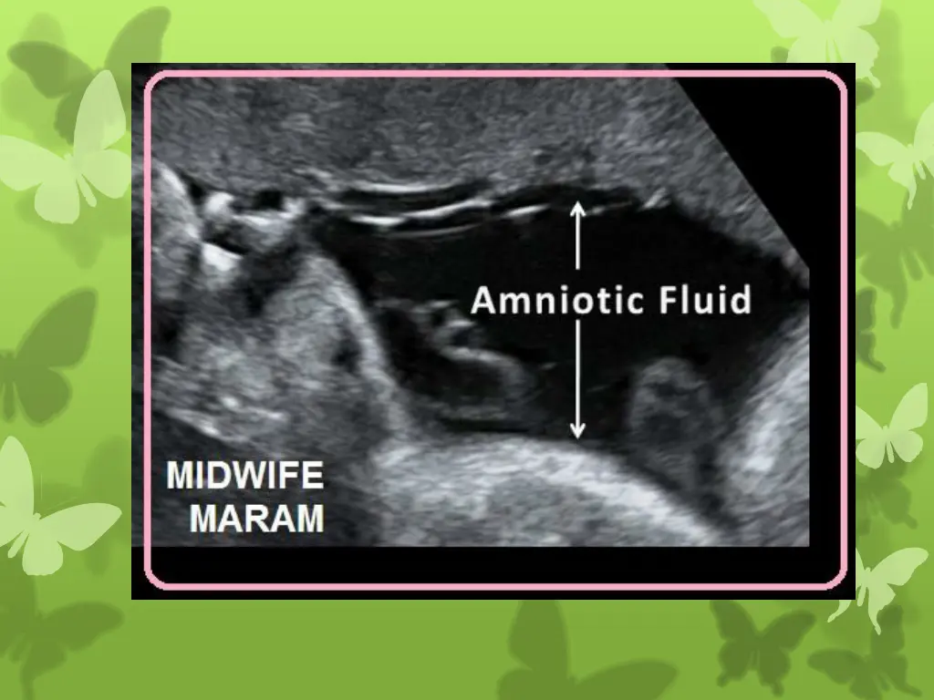 slide18