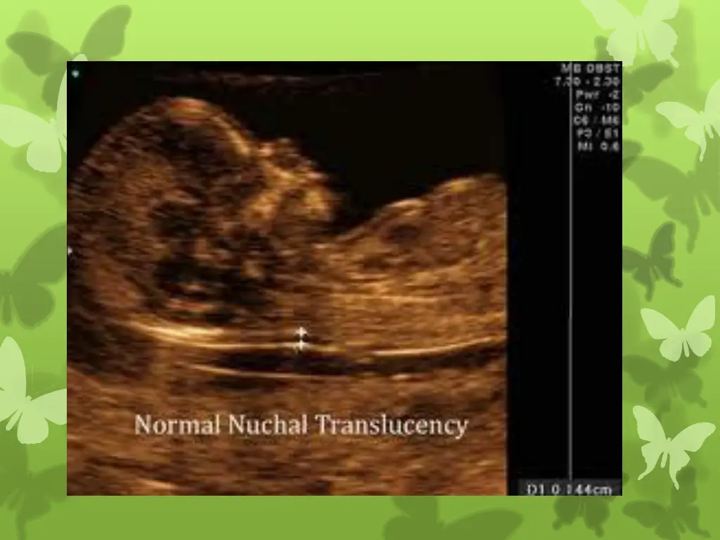 slide8