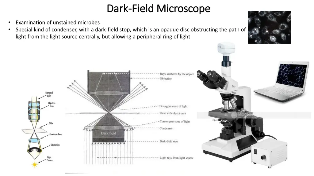dark dark field microscope field microscope