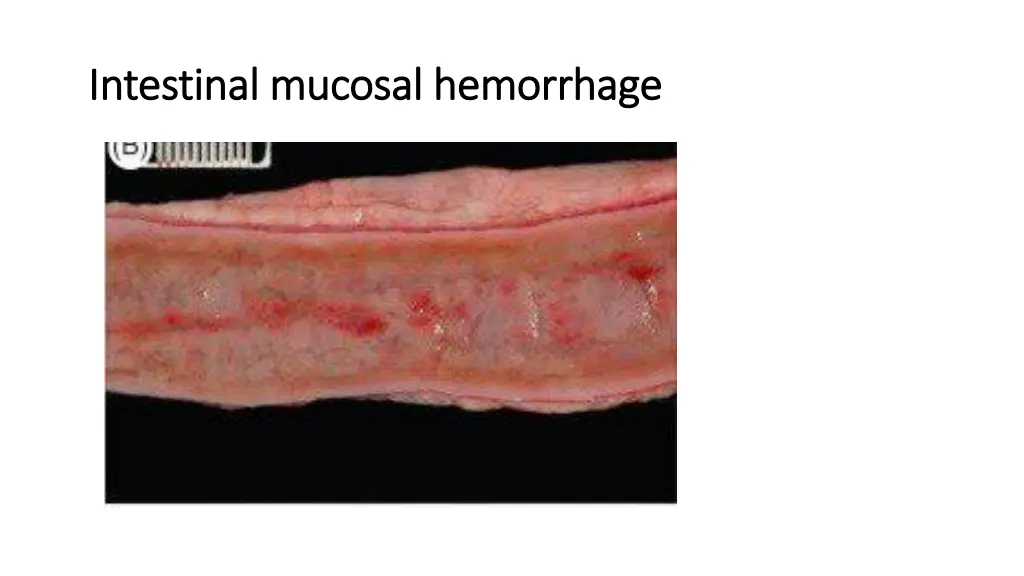 intestinal mucosal hemorrhage intestinal mucosal