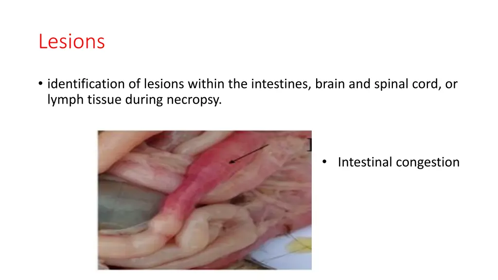 lesions