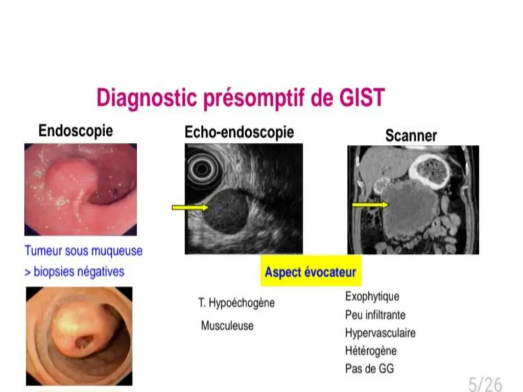 slide5