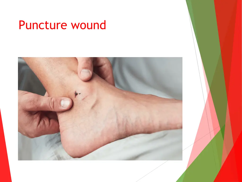puncture wound