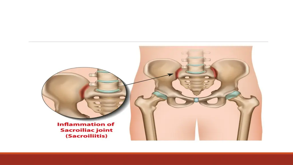 slide4