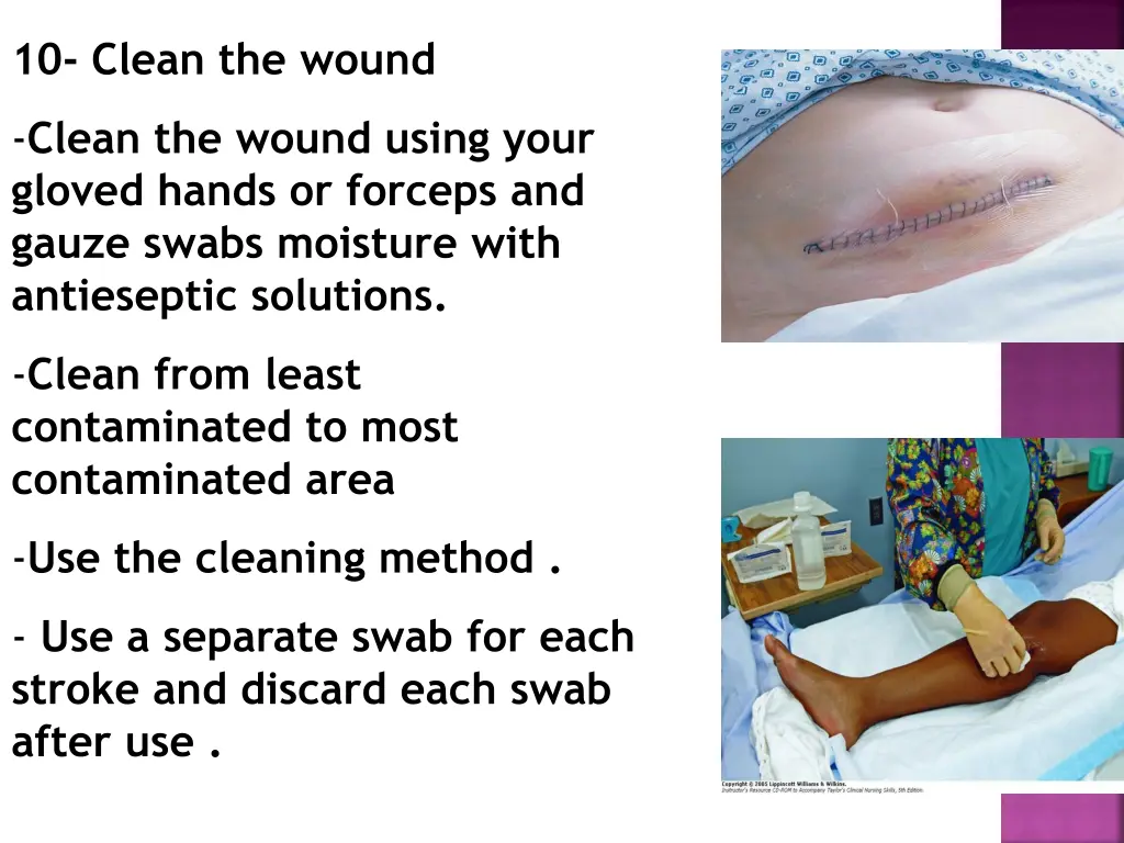 10 clean the wound