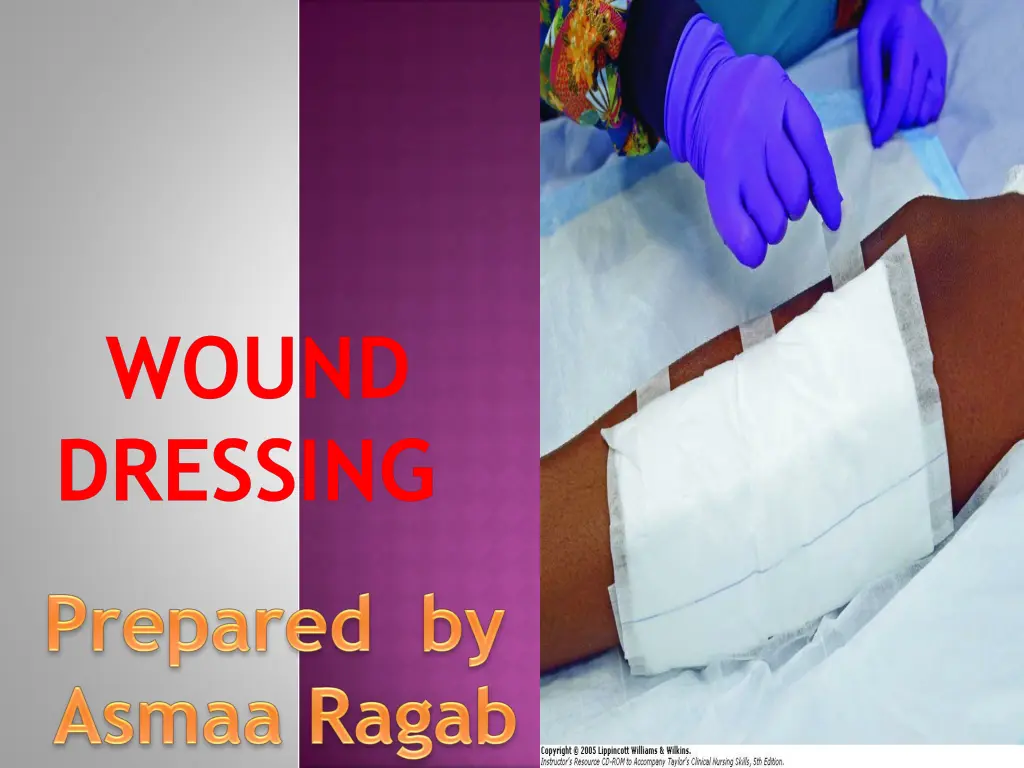 wound dressing