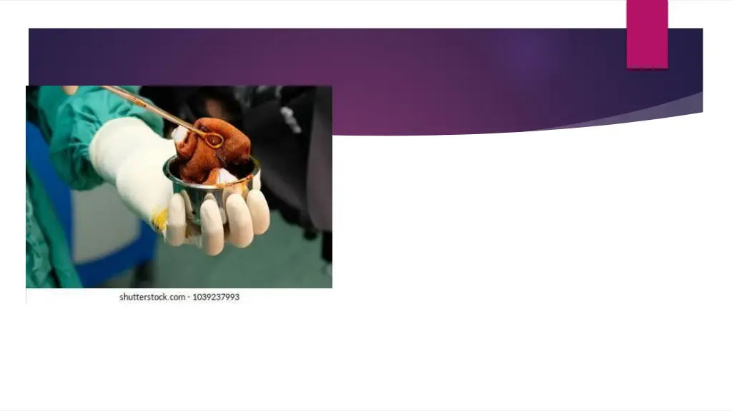 slide25