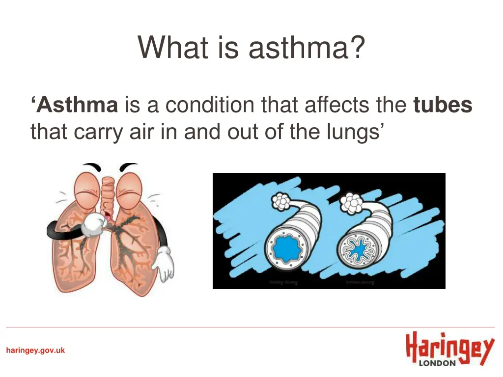 what is asthma