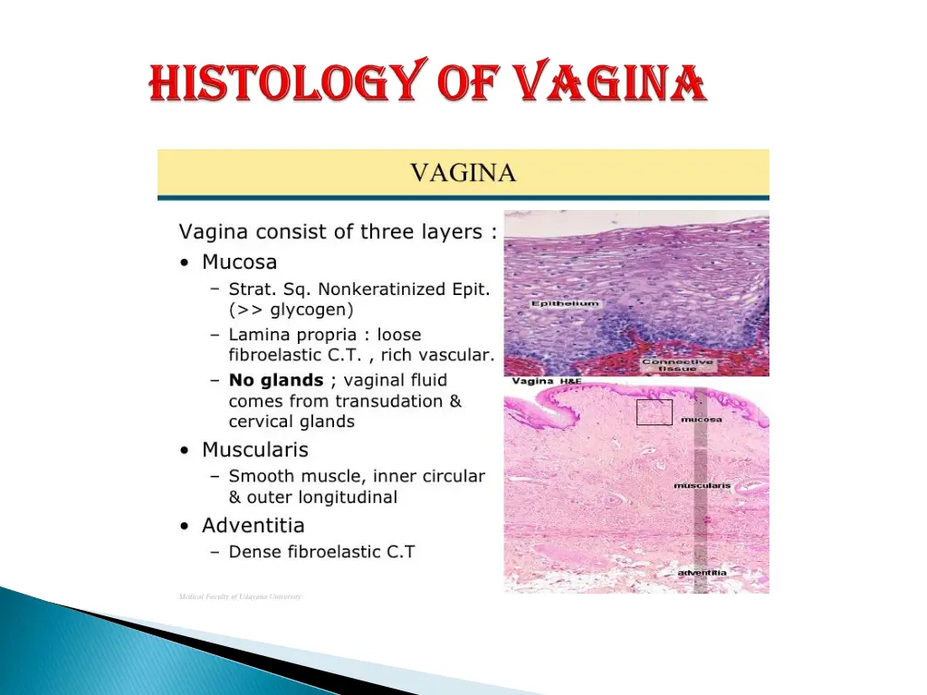slide11