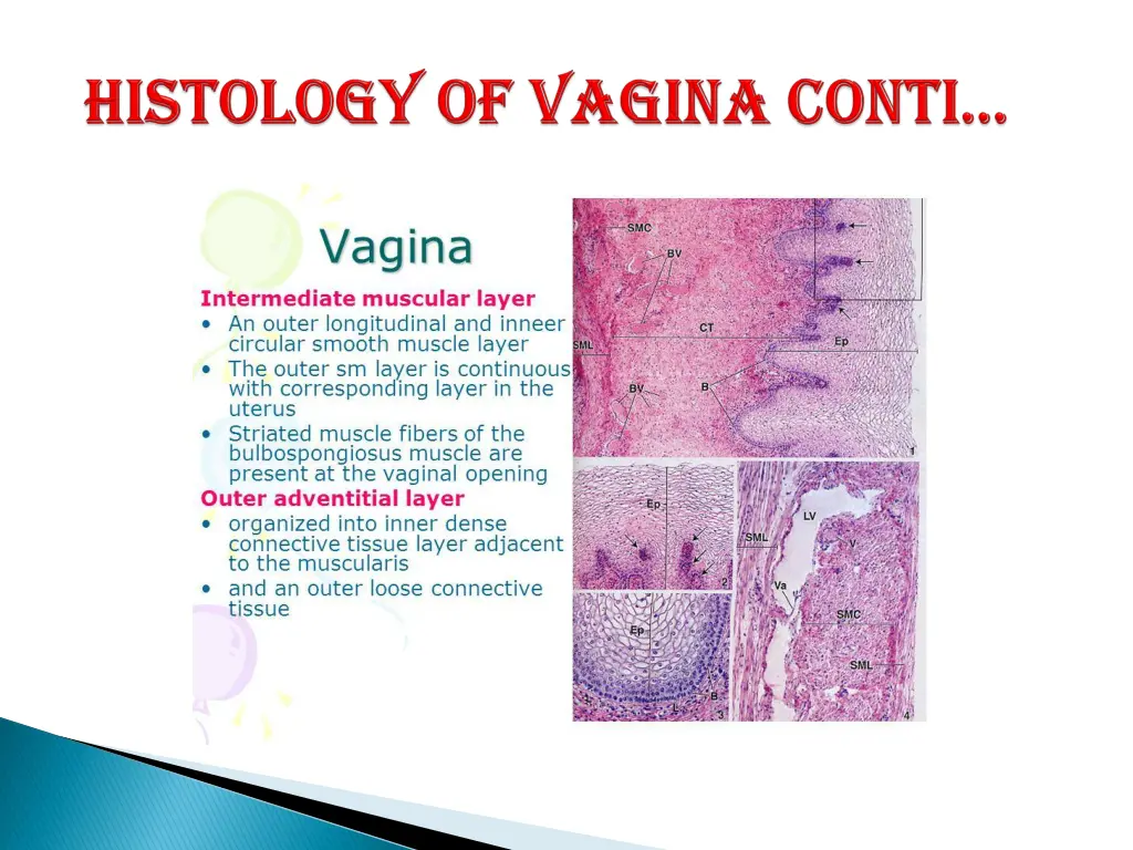 slide12