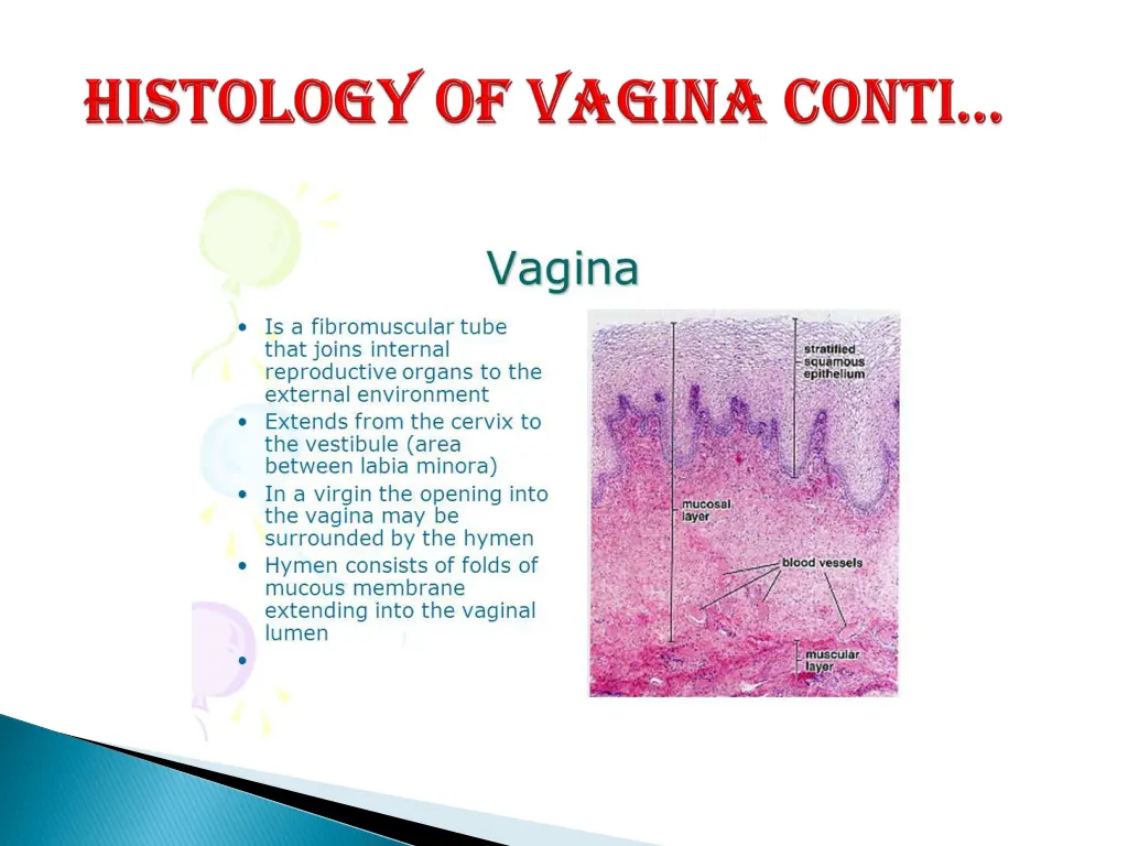 slide13