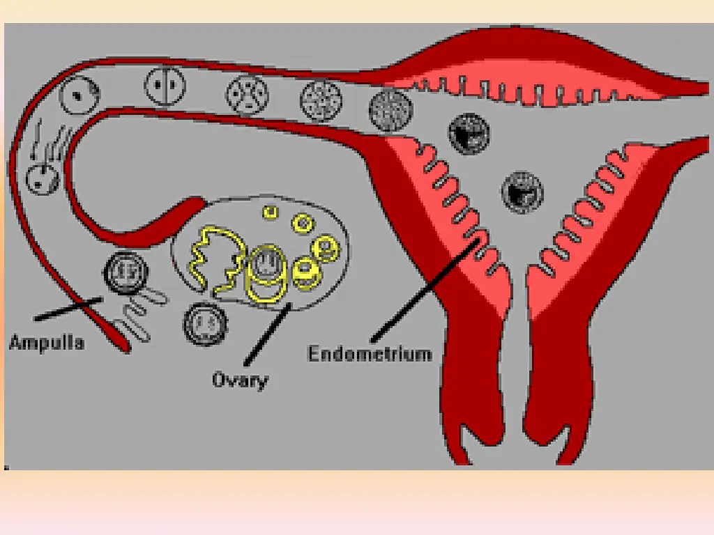 slide12