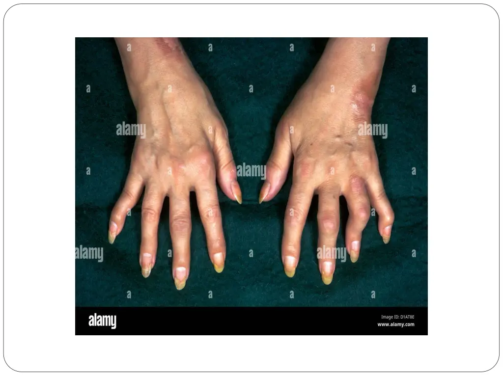 slide19