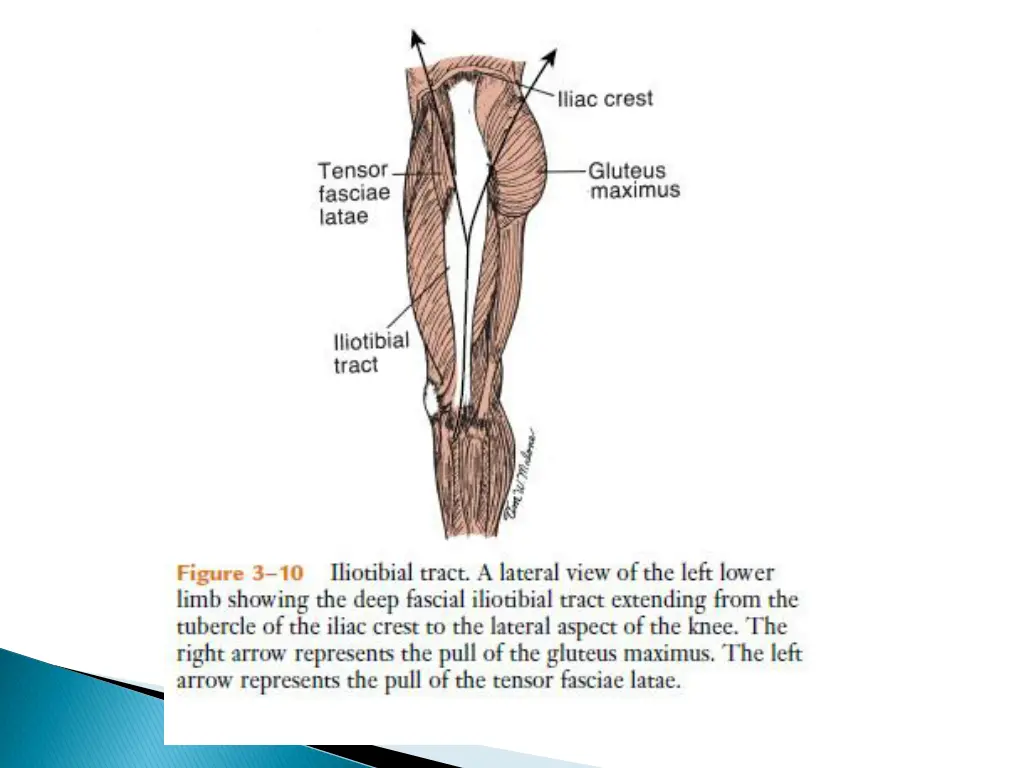 slide31