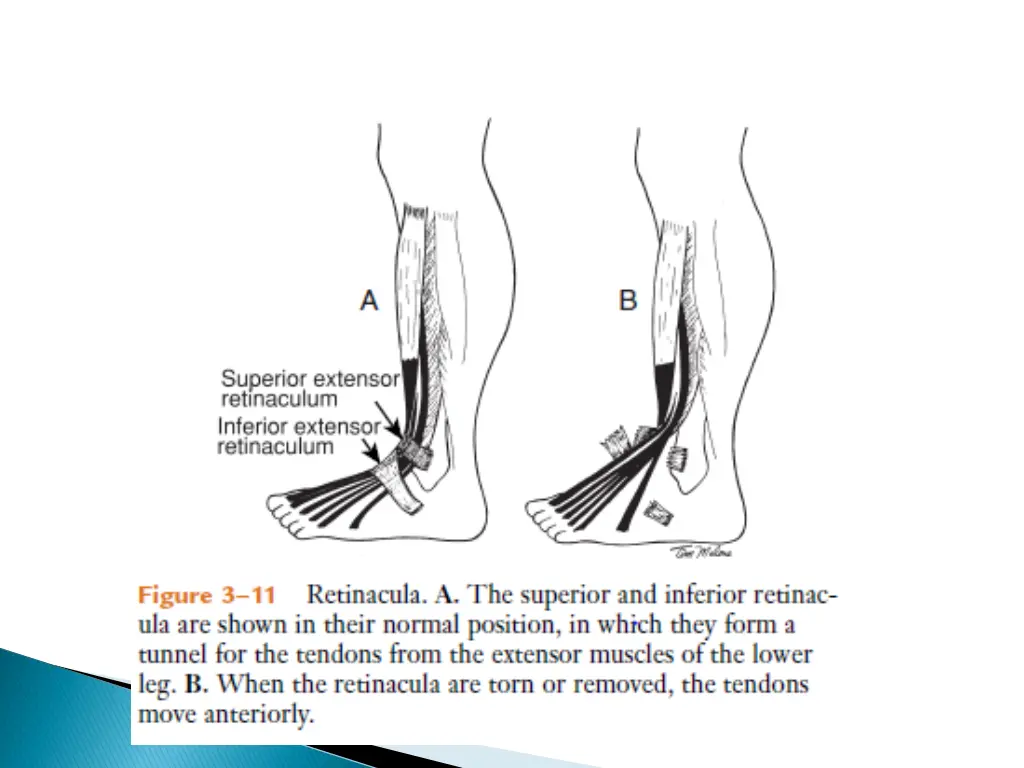 slide33