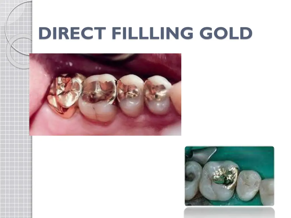 direct fillling gold