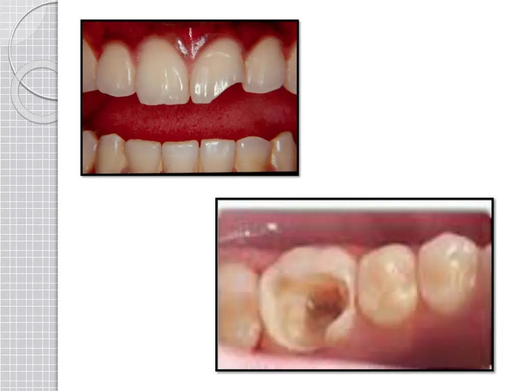 slide4