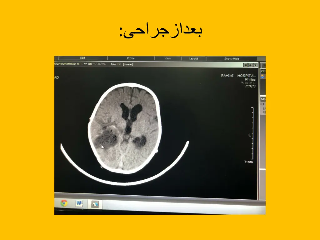 slide3