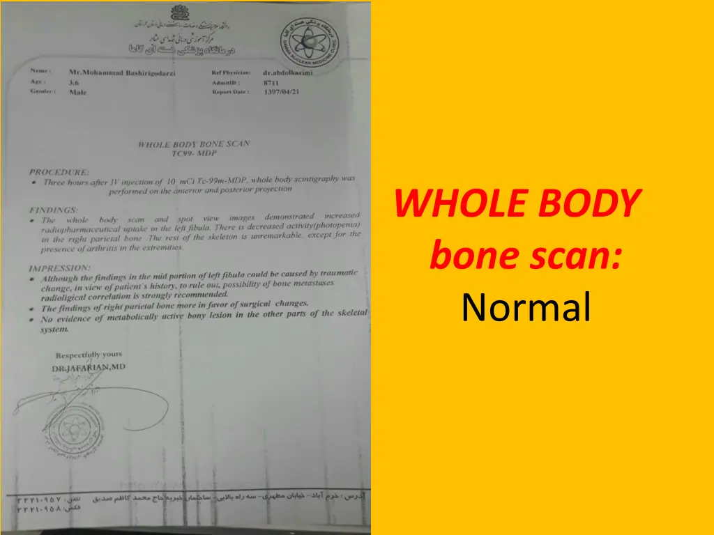 whole body bone scan normal