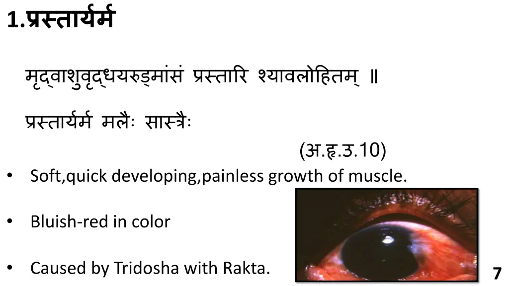 slide7