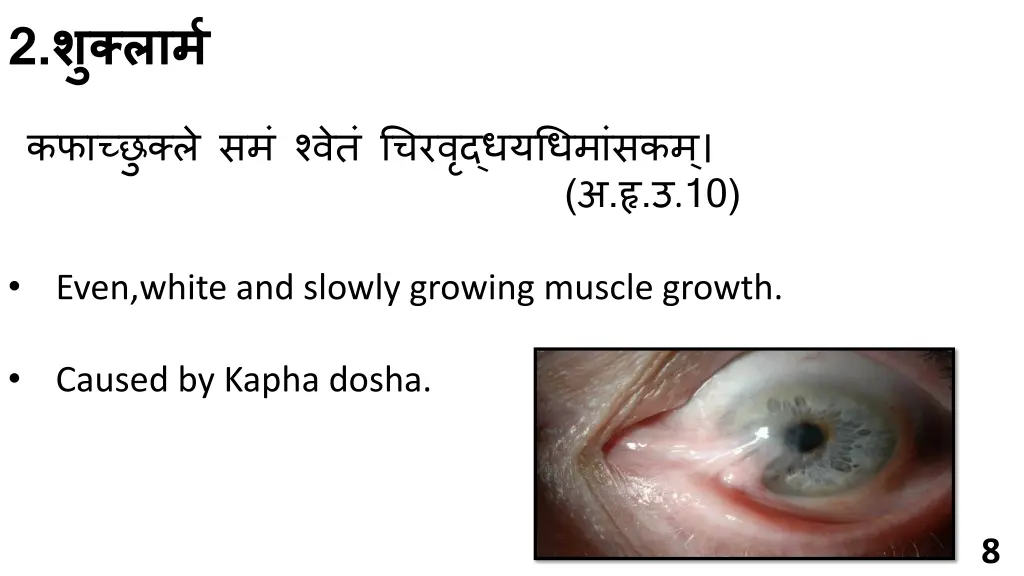 slide8
