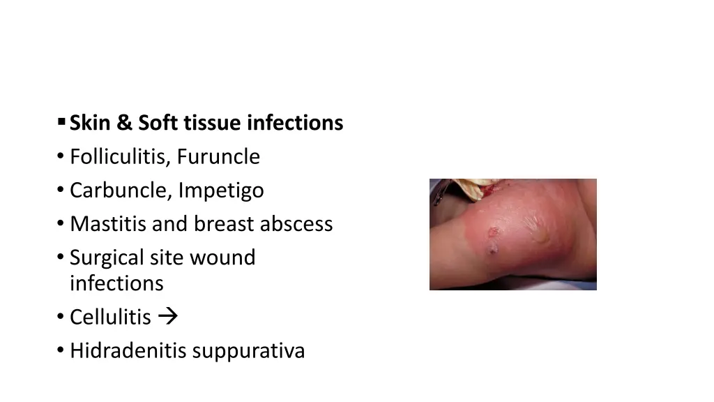 clinical manifestations