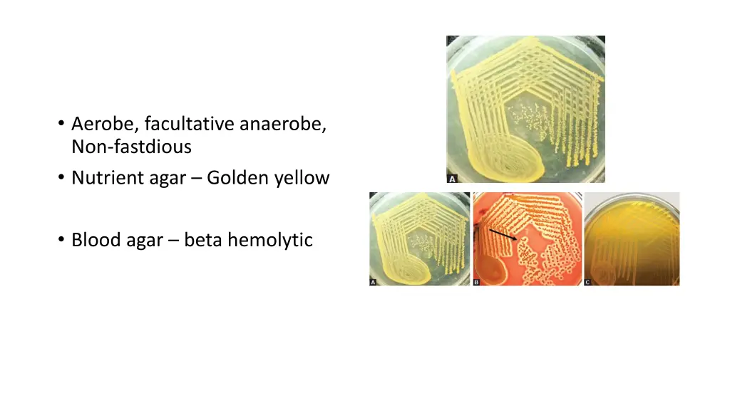 laboratory diagnosis laboratory diagnosis culture