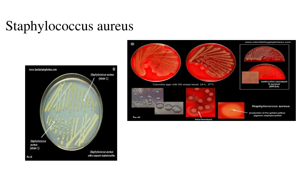 staphylococcus aureus