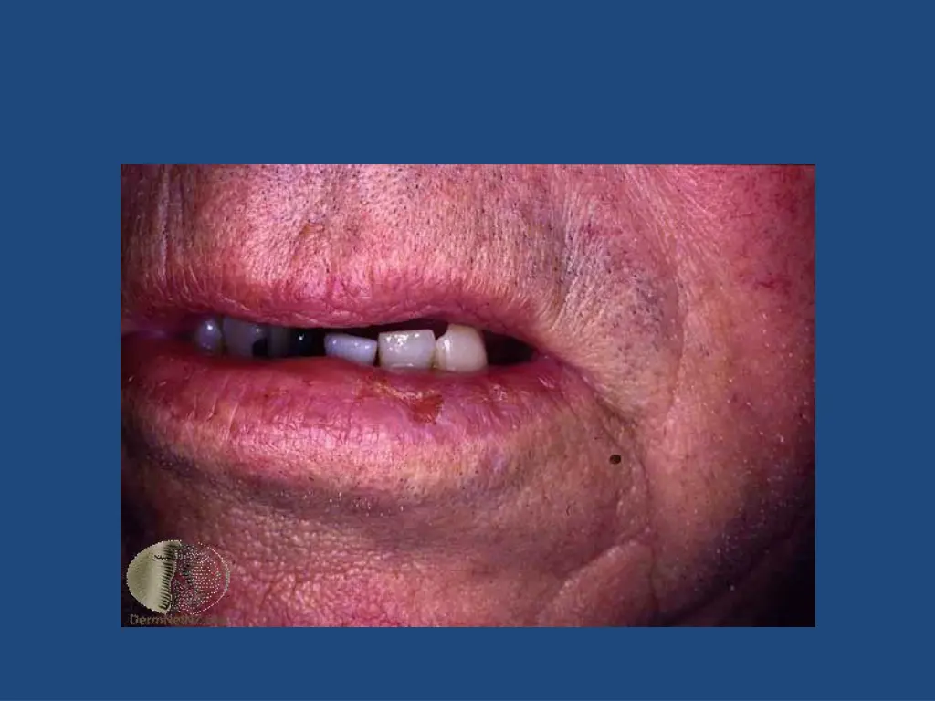 slide22