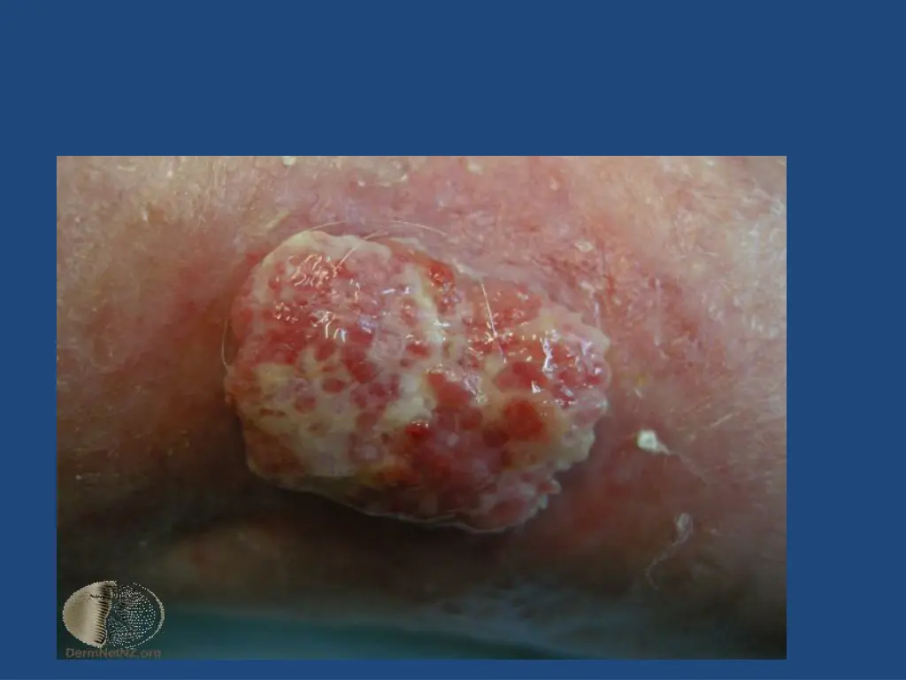 slide23