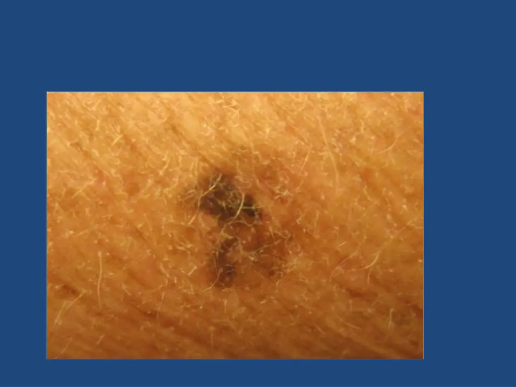slide31