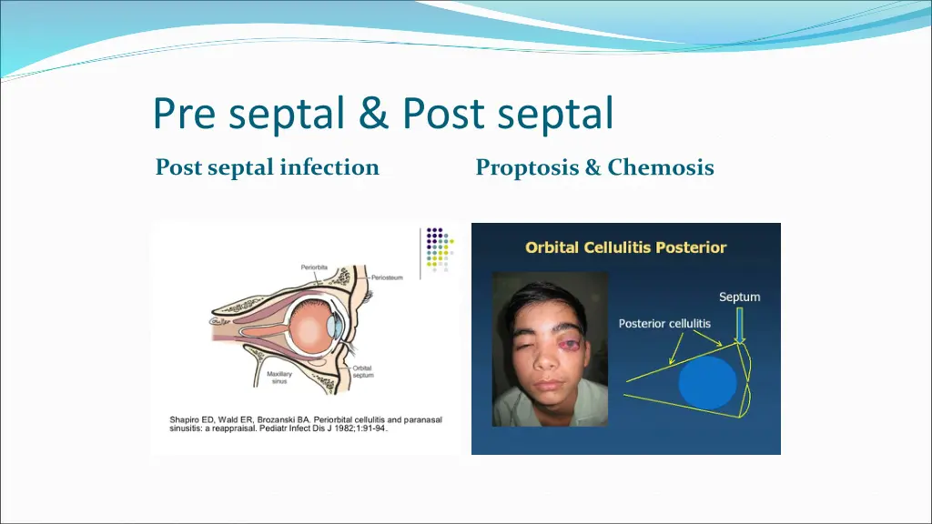 pre septal post septal