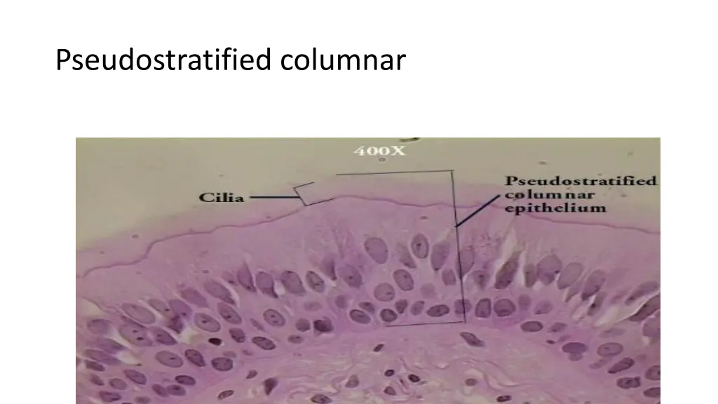 pseudostratified columnar