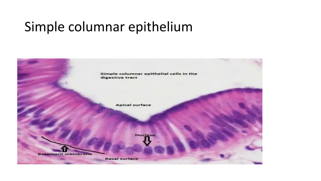 simple columnar epithelium