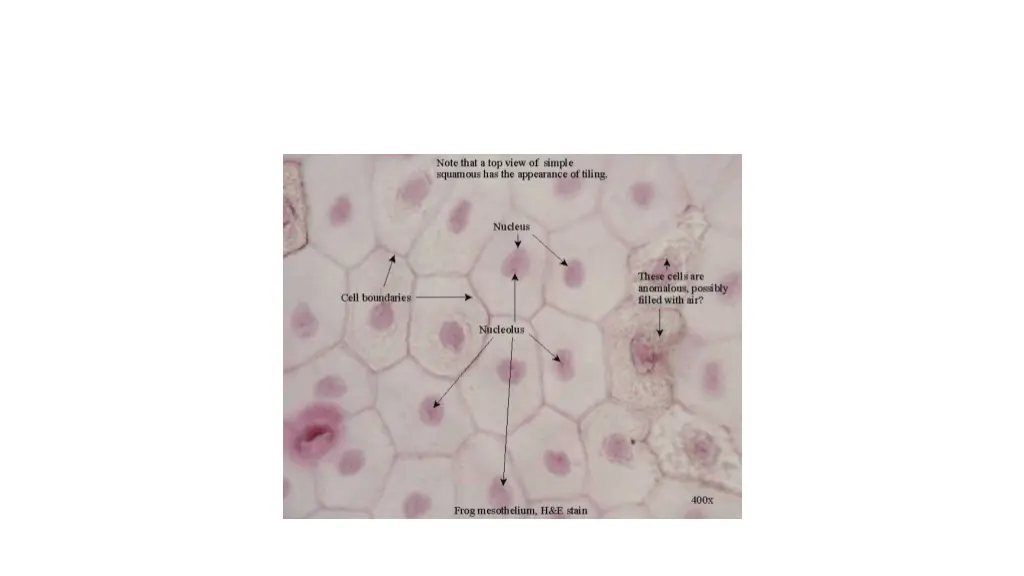 simple squamous epithelium