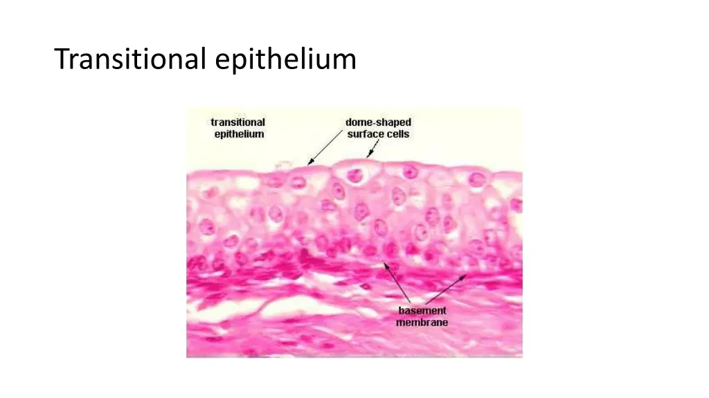transitional epithelium