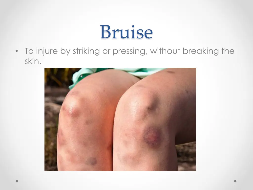 bruise