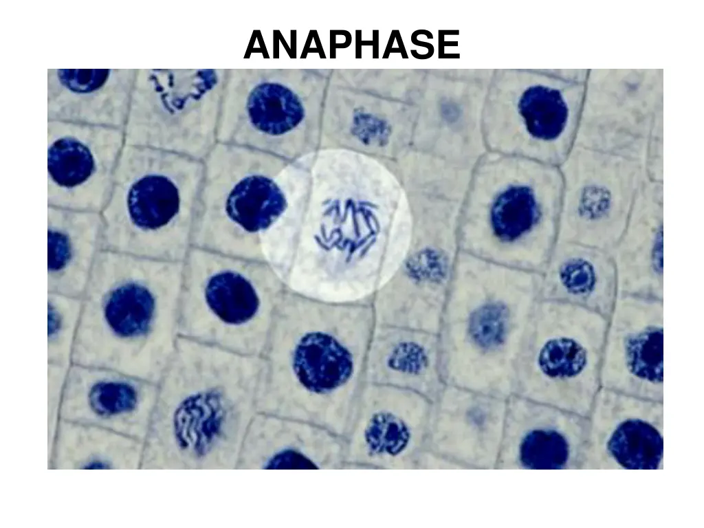 anaphase 1