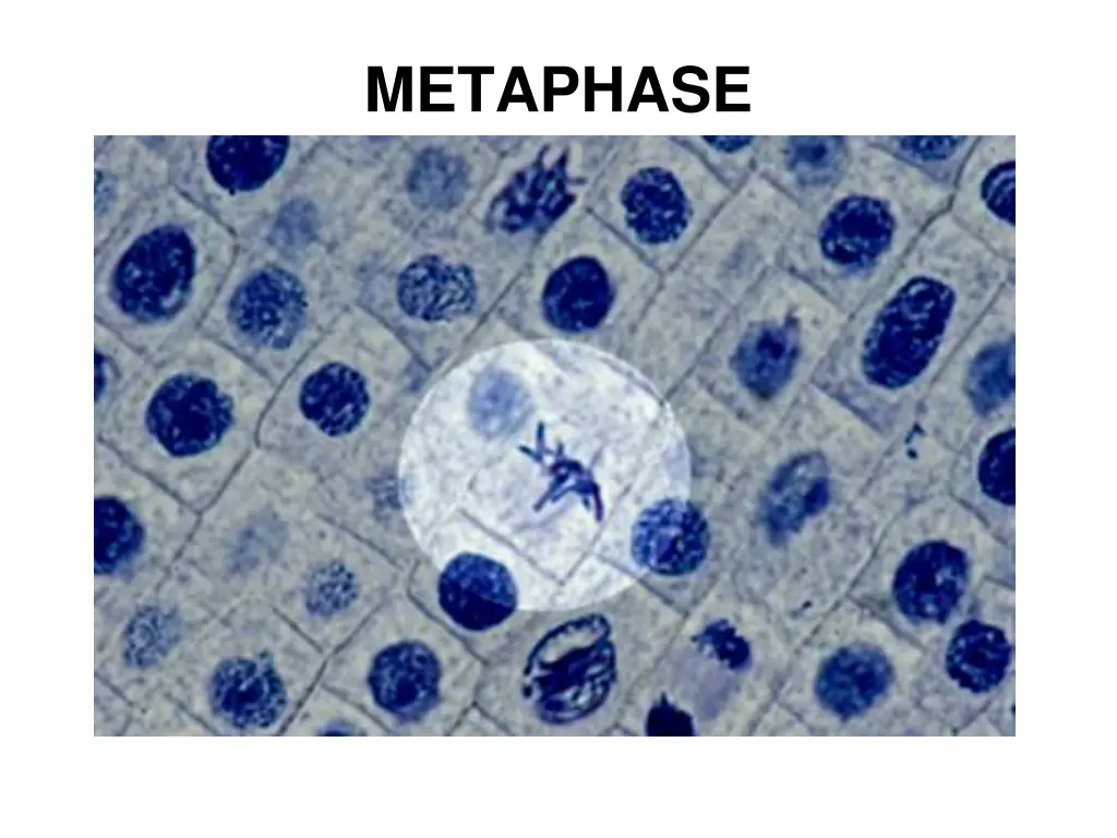 metaphase 1
