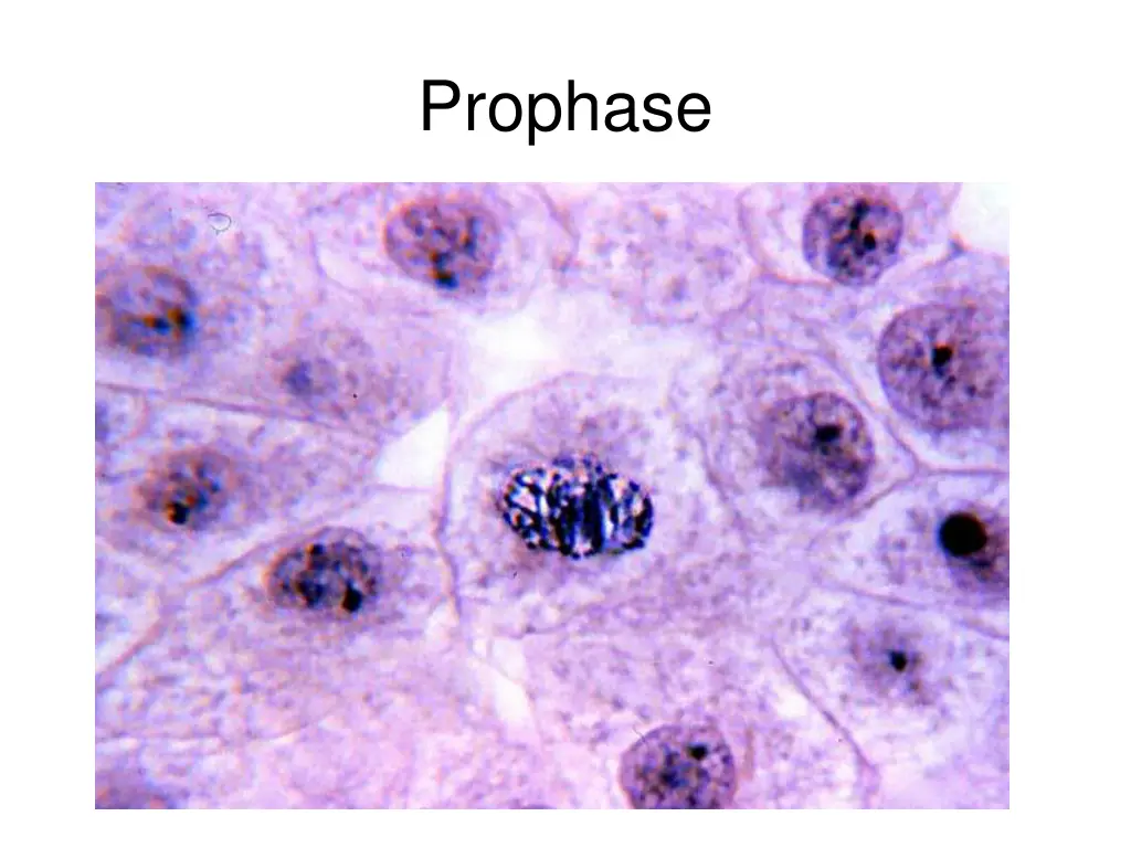 prophase 1