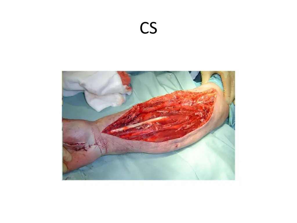 slide19
