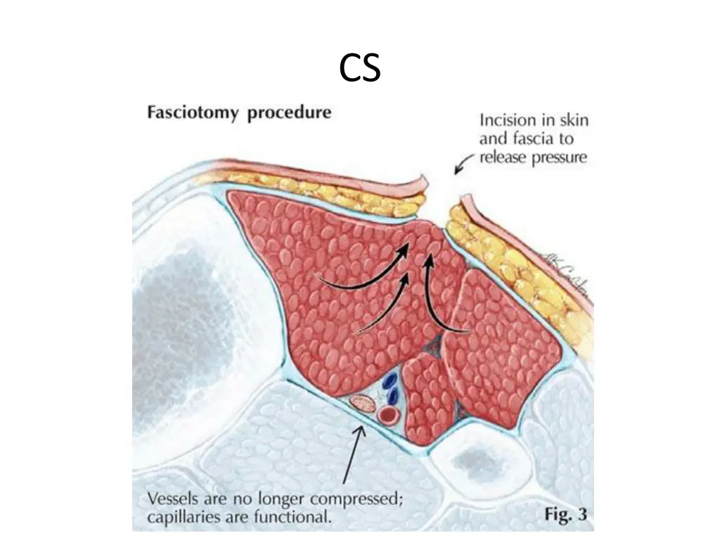 slide20