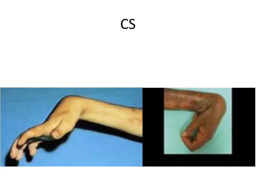 slide26