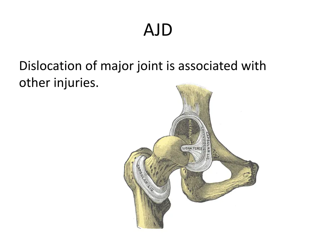 slide39