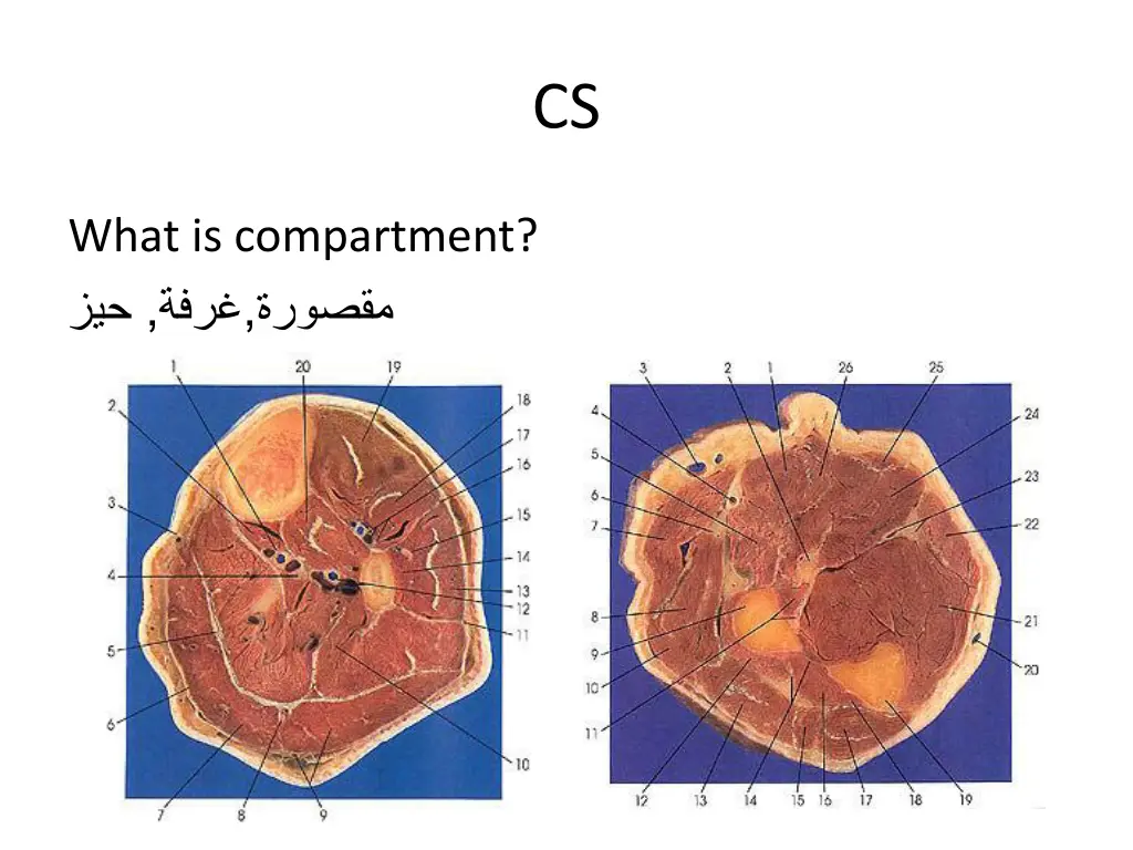 slide4
