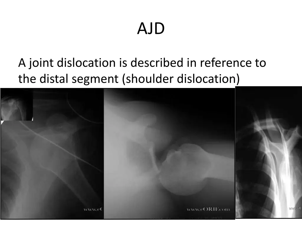 slide43