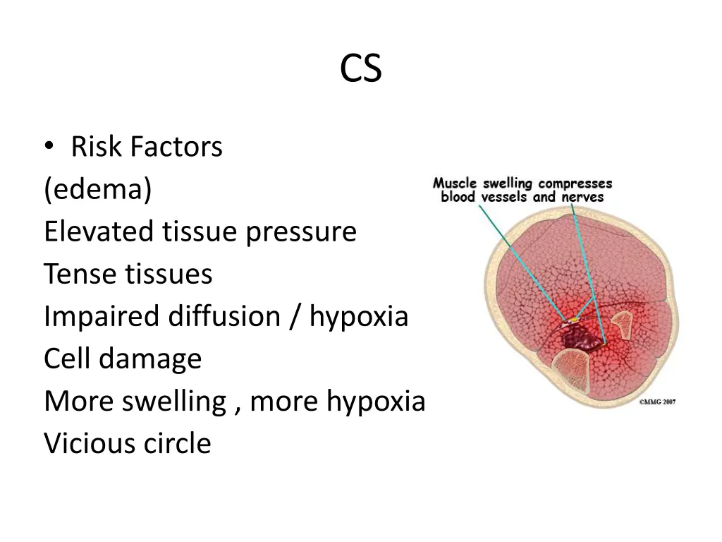 slide9