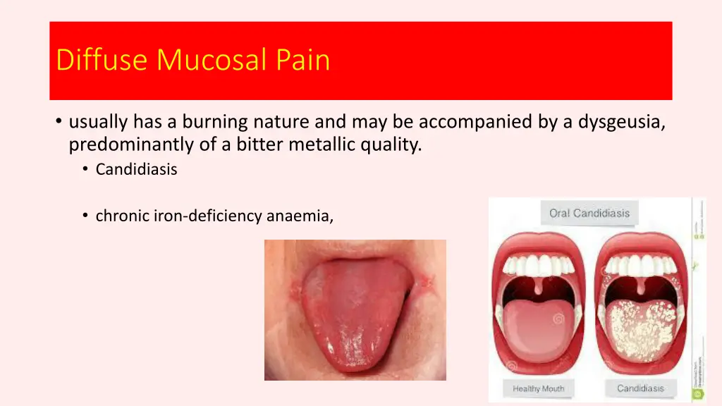 diffuse mucosal pain