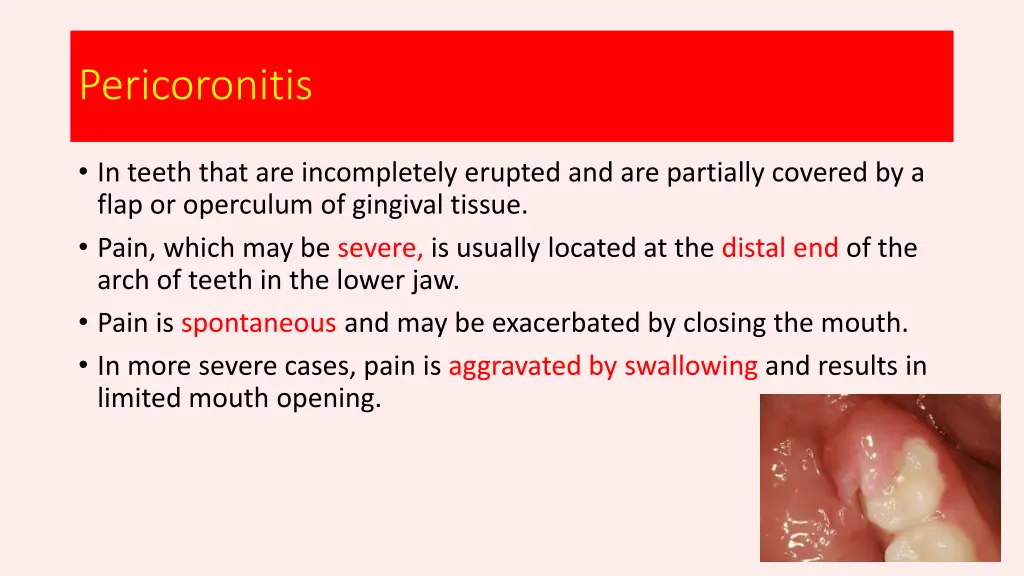 pericoronitis