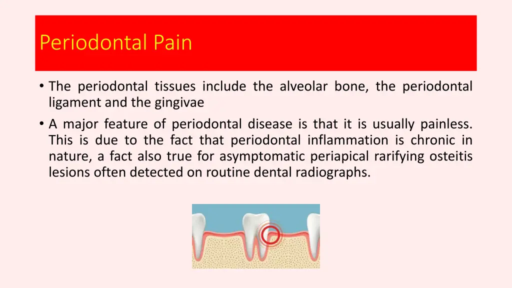 periodontal pain